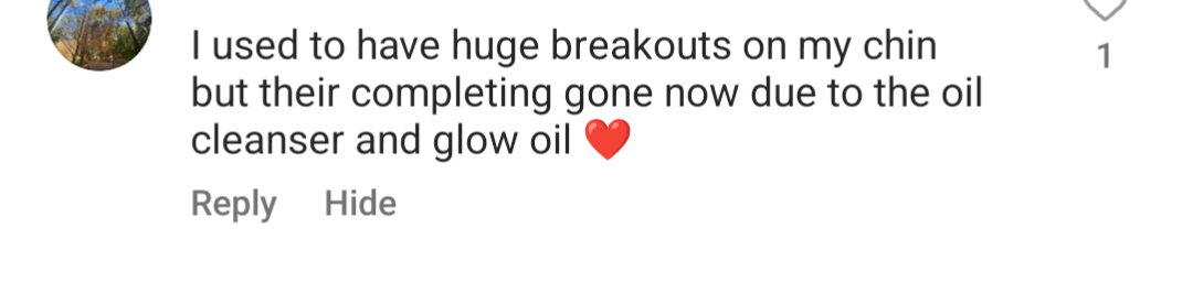 positive review for a face oil that helps with acne scarring reducing breakouts helping with hormonal pimples and reducing post inflammatory pigmentation